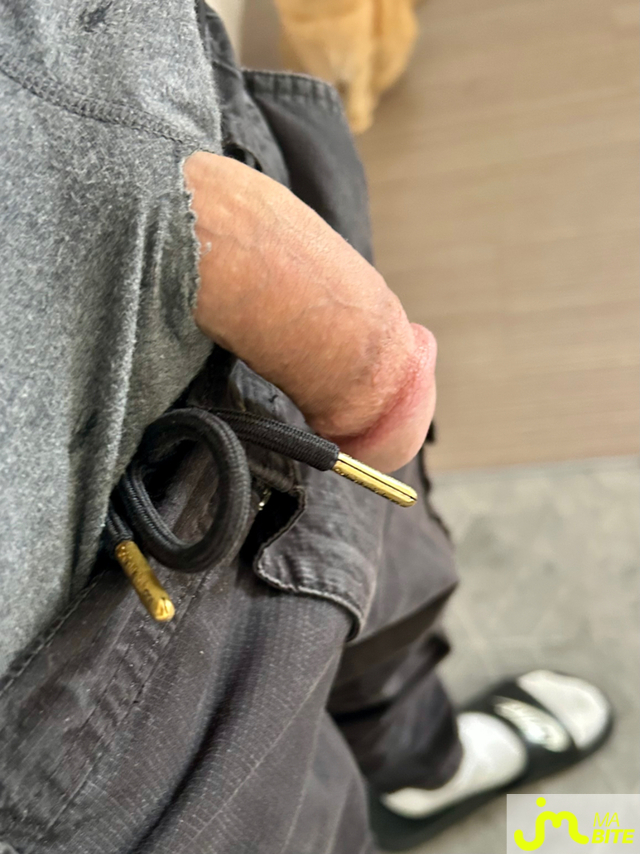 Photos de bites : Le serpent s&rsquo;est fait la malle