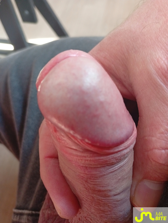 bites de castration83 