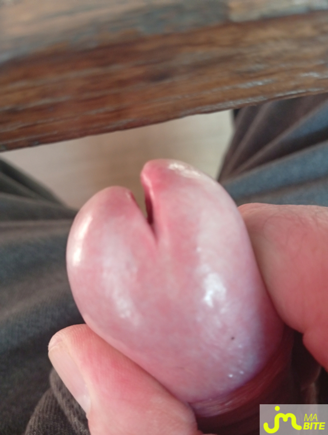 bites de castration83 