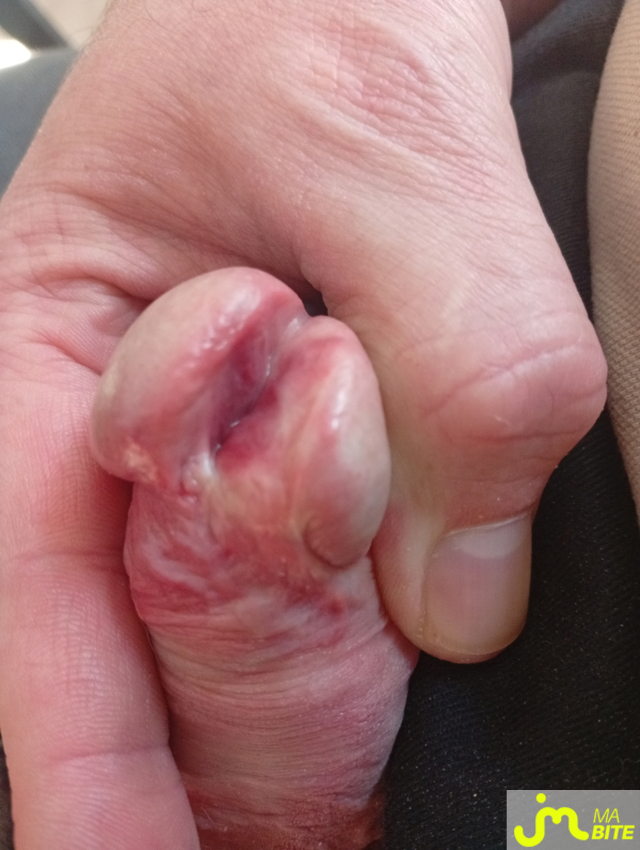 bites de castration83 