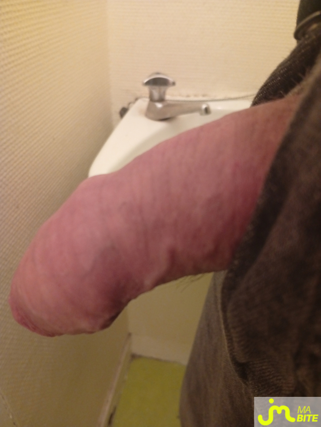 bites de castration83 