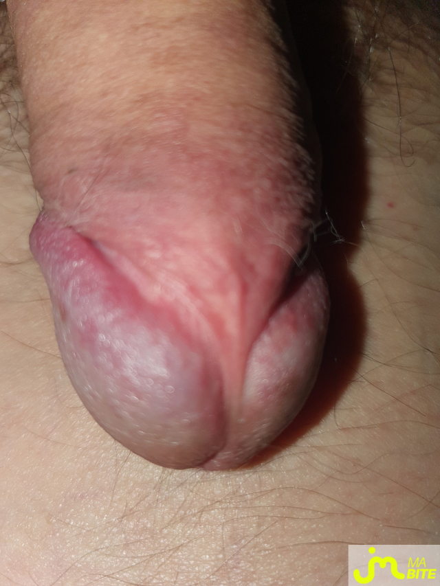 bites de Gauledorak 