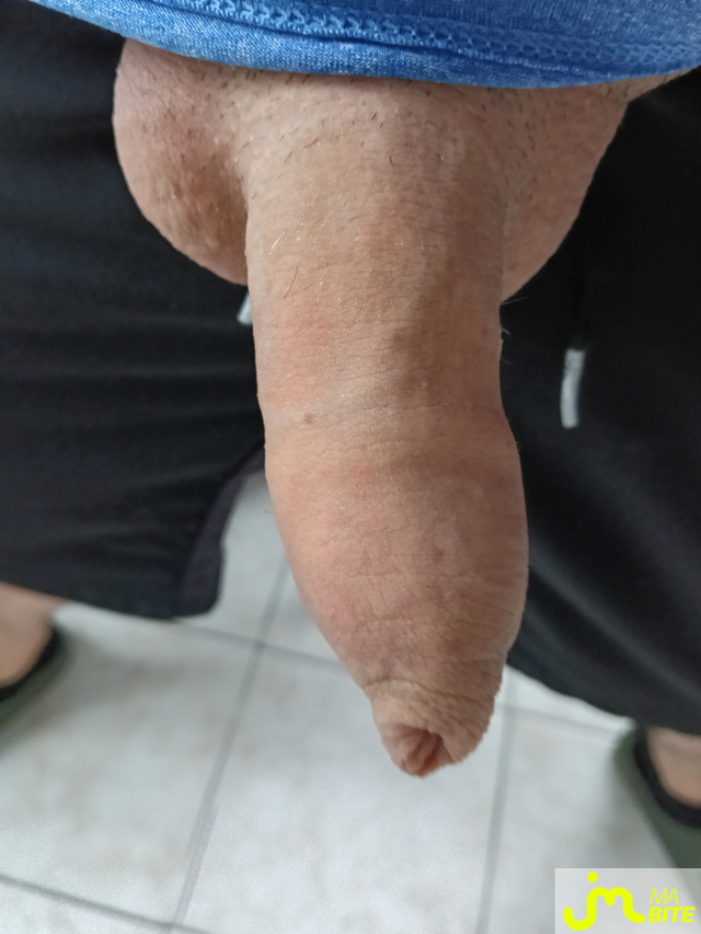 bites de rod2462