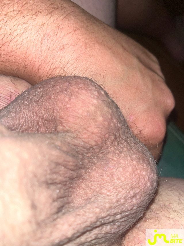 bites de La bite72