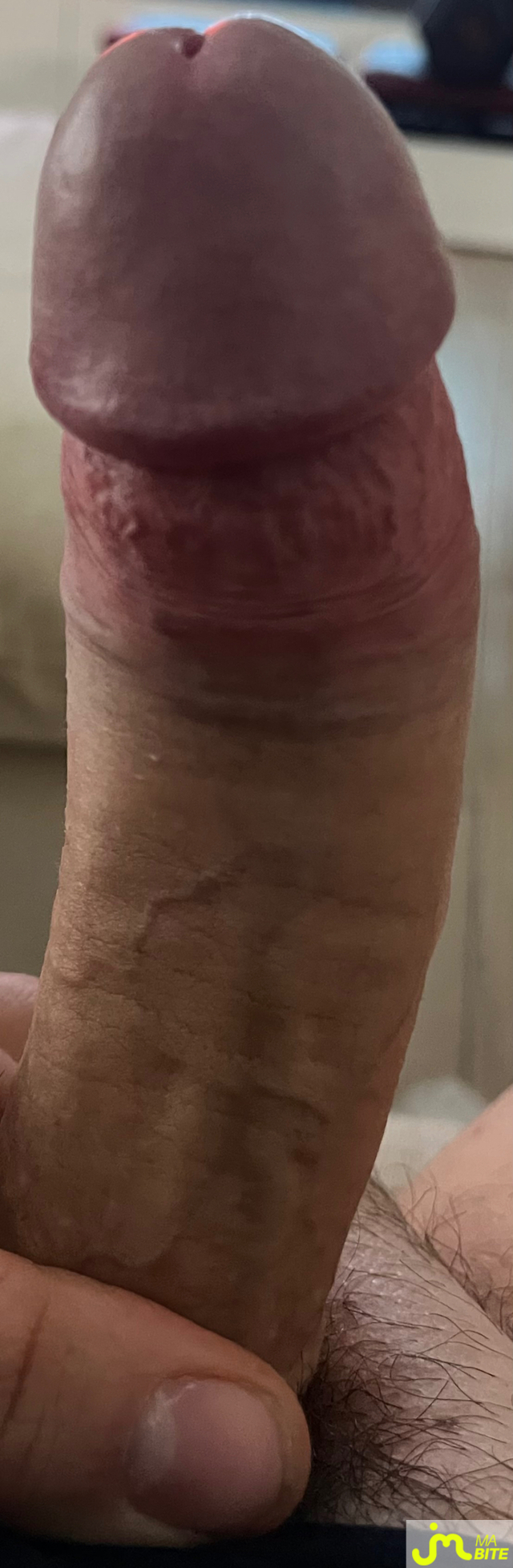 bites de Kylian49fd
