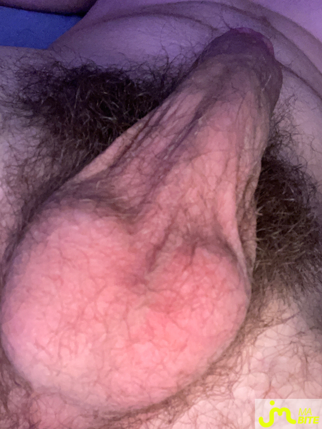bites de petitebite15