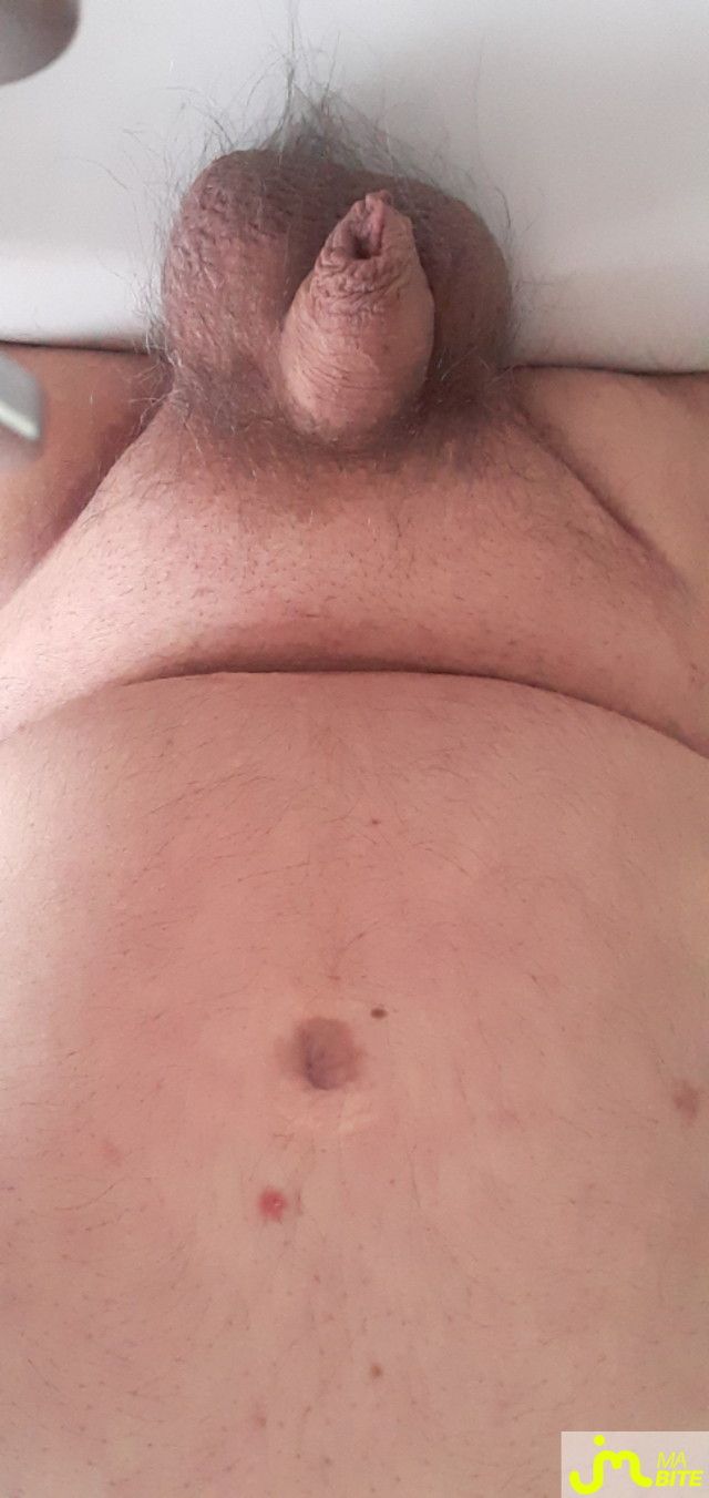 bites de jolicul76