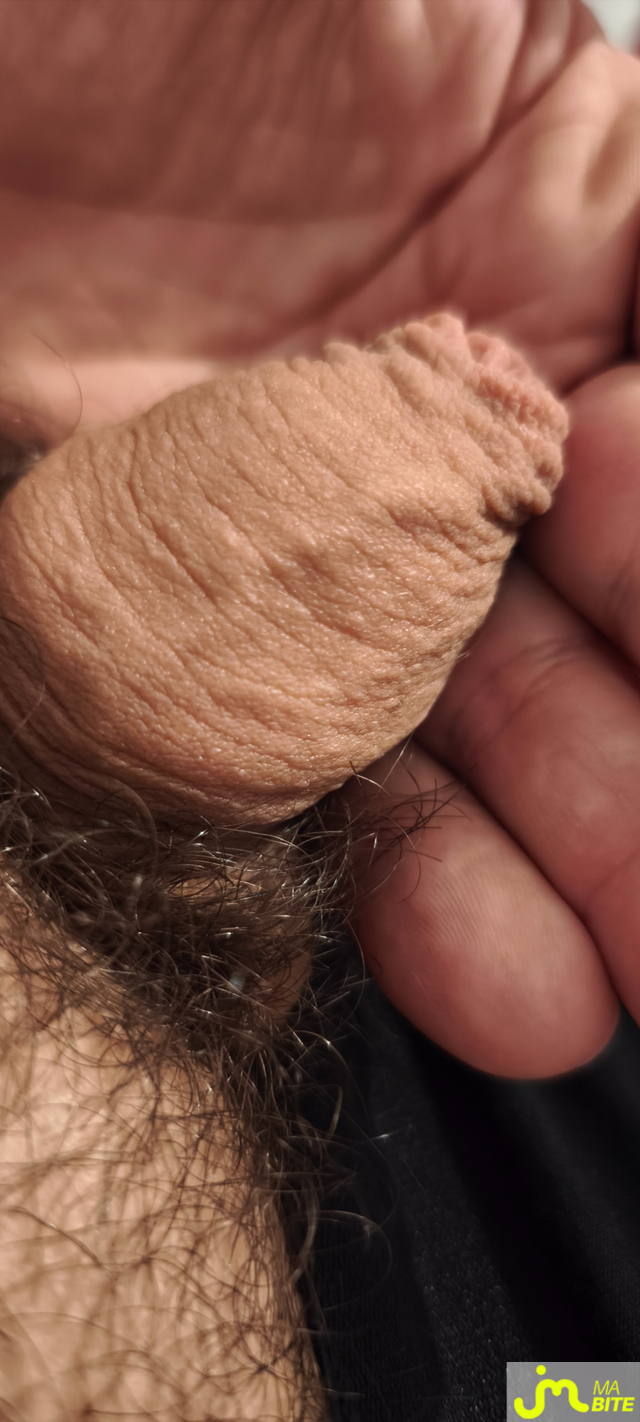 bites de Badoo976269