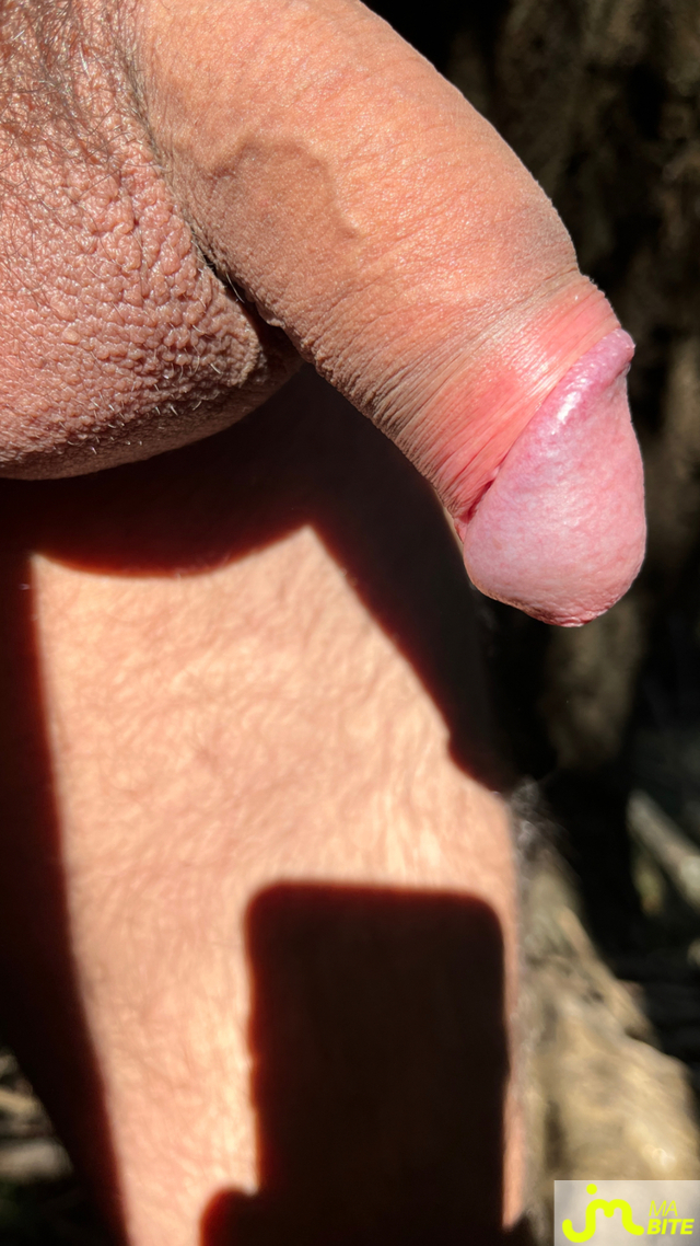 bites de Jessito