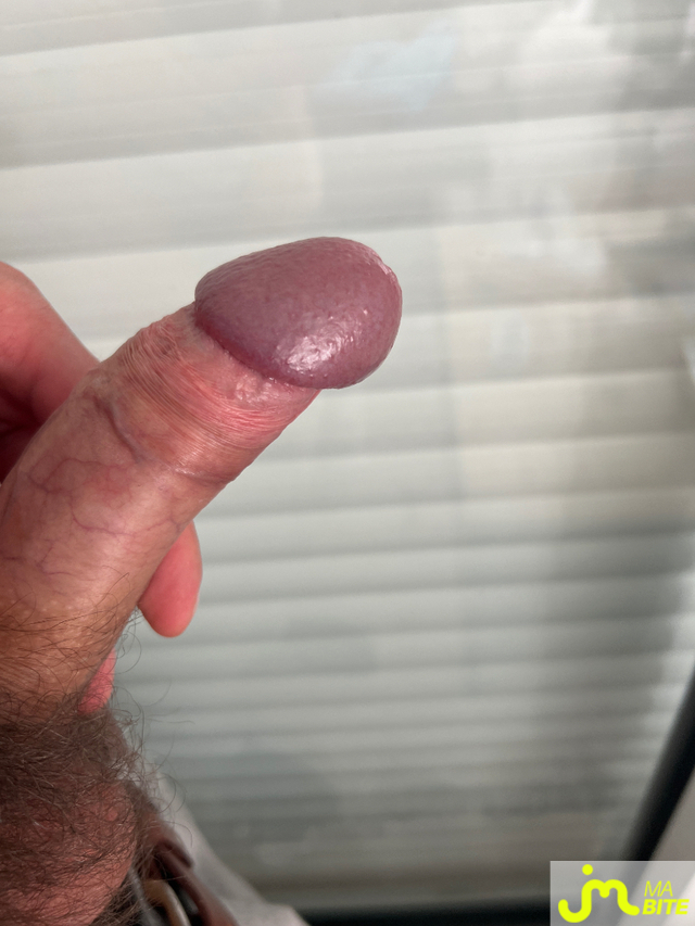 bites de Johngwe