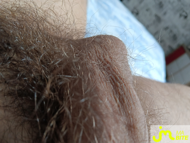 bites de Nairod