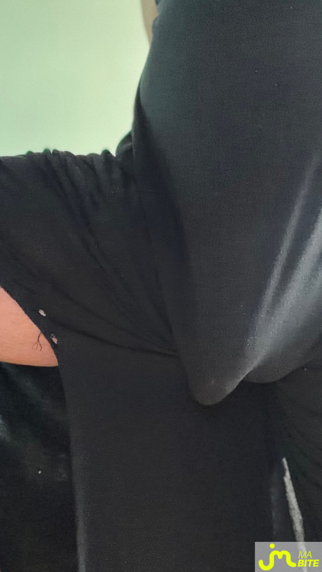 bites de Menelas