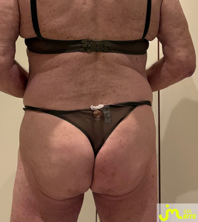 bites de Menelas