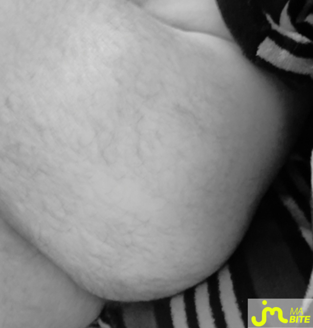 bites de Dur dur 