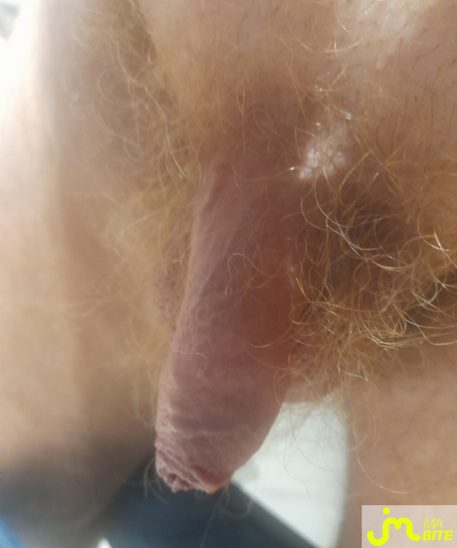 bites de mimimilo 