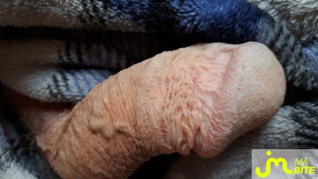 bites de Casper 