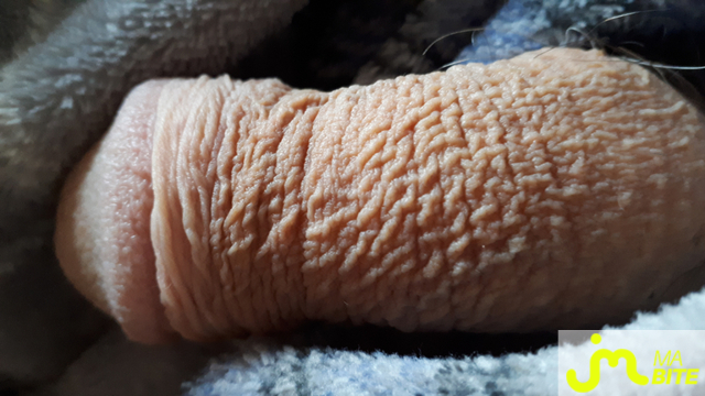 bites de Casper 