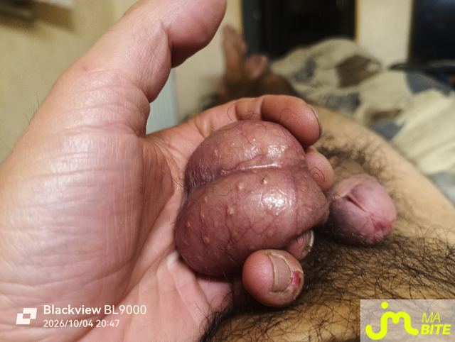 Photos de bites : 5