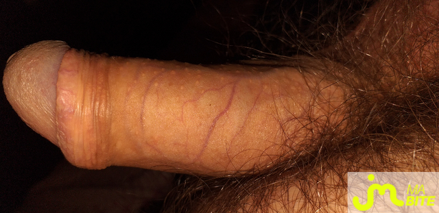 bites de marcojack