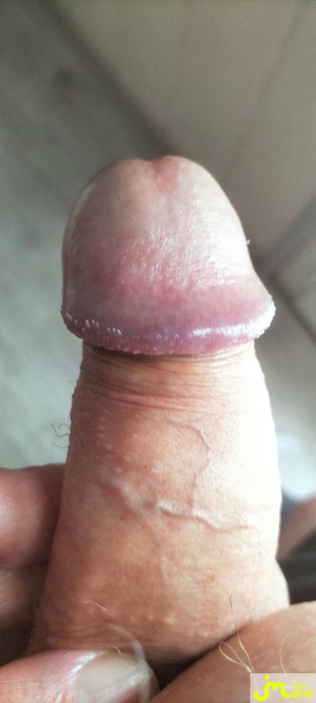 bites de Albatros64 