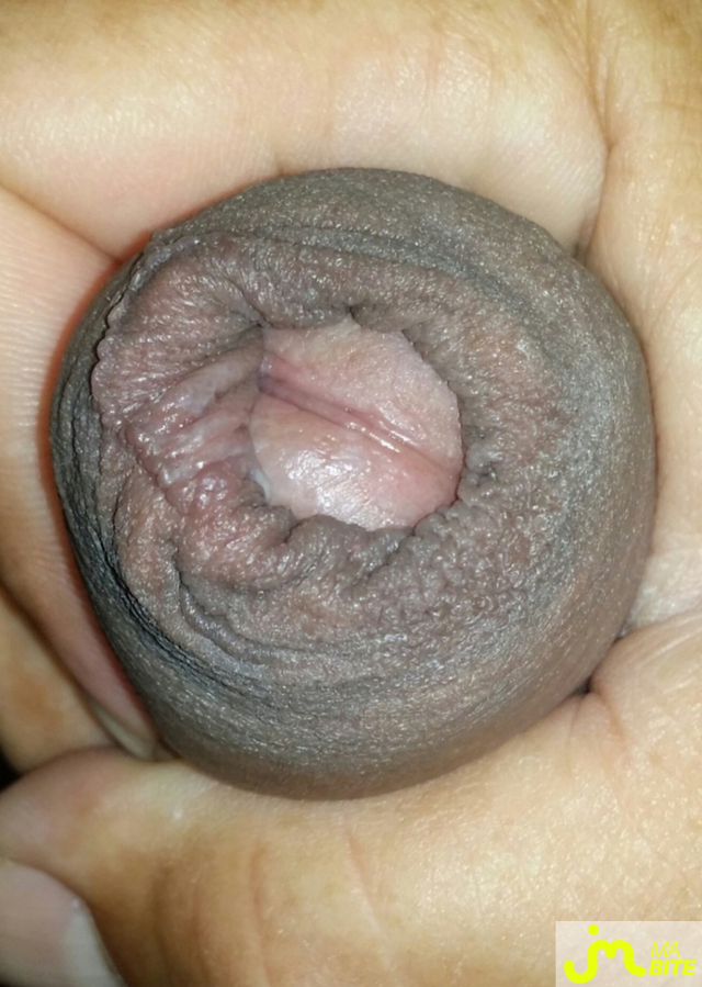 bites de ricou47