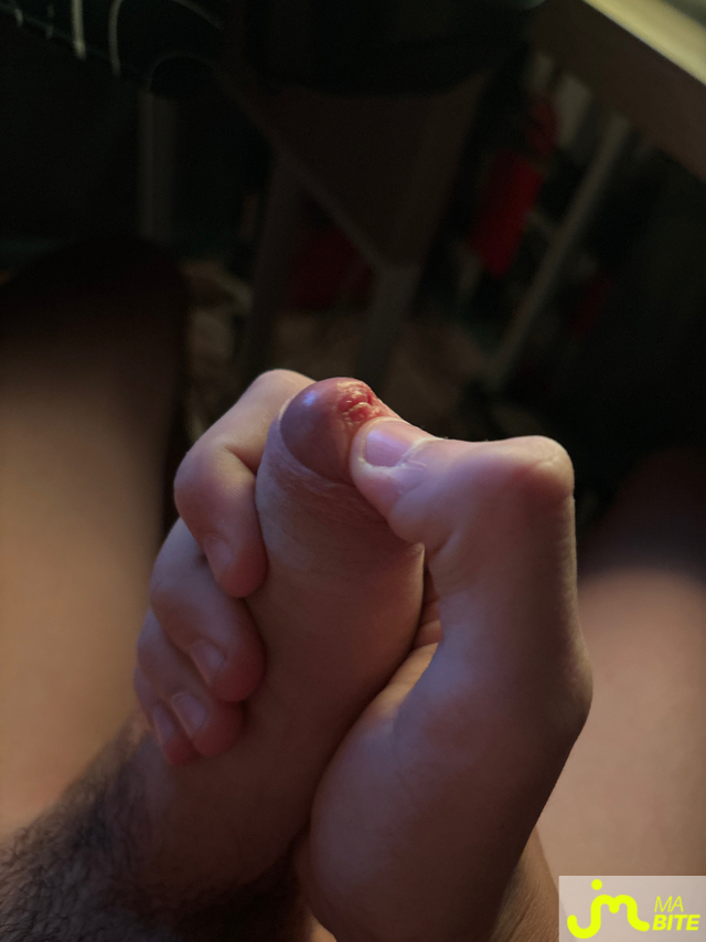bites de cc=coucou 