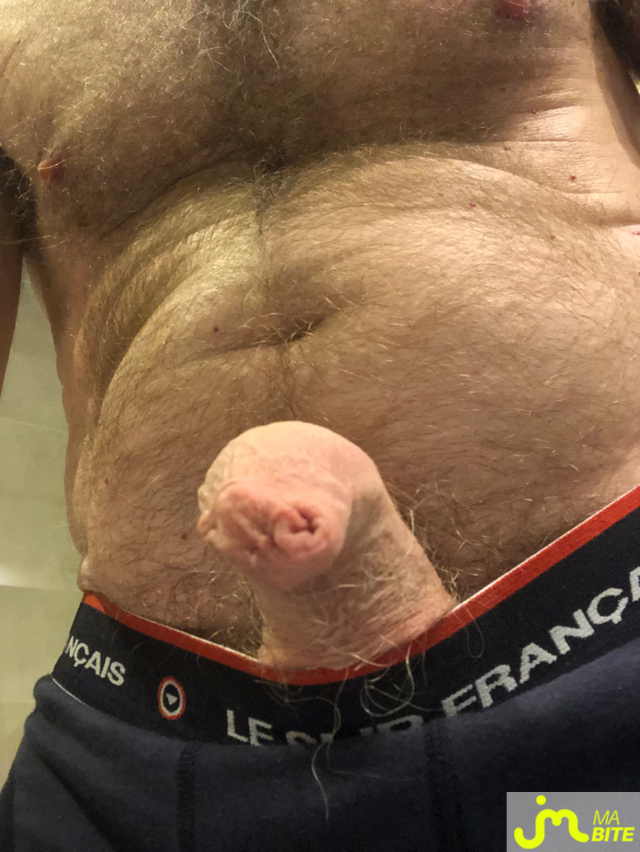 bites de longprepuce