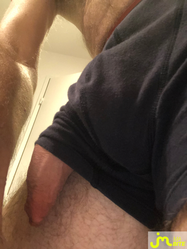 bites de longprepuce