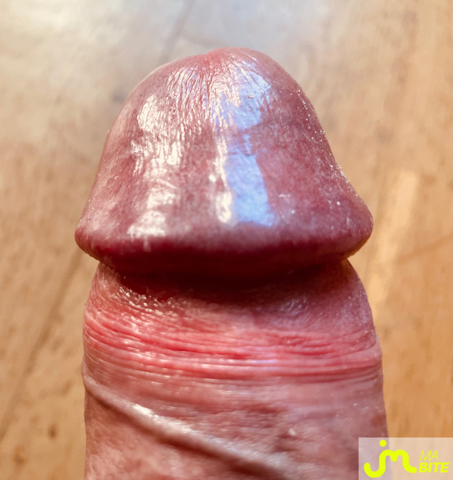 bites de Antoine03410