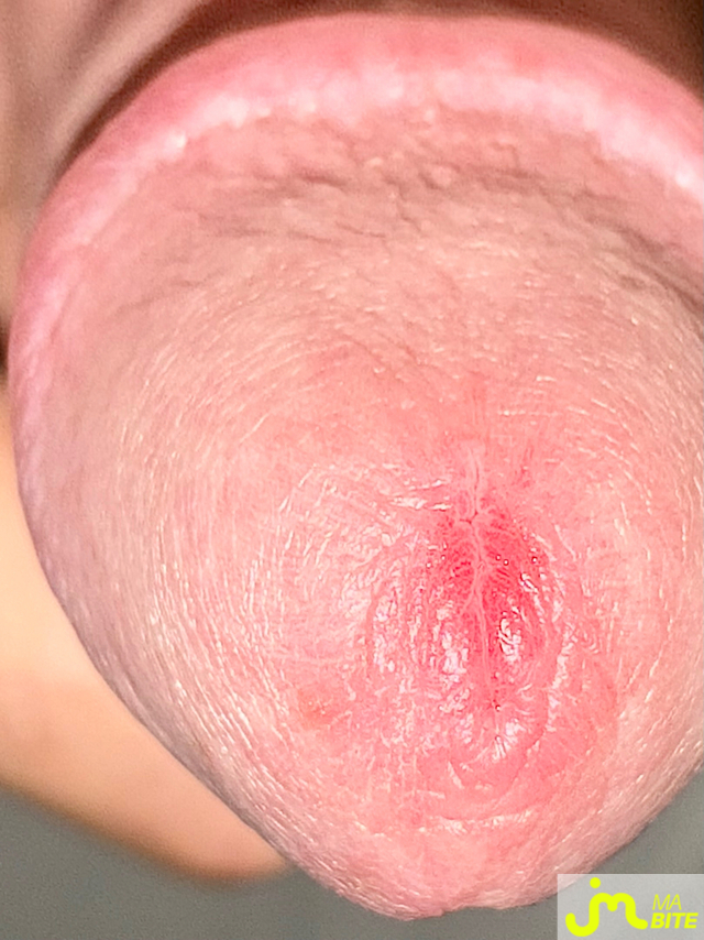 bites de 14x13