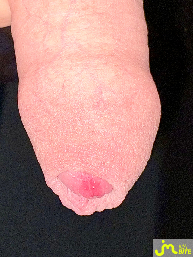 bites de 14x13