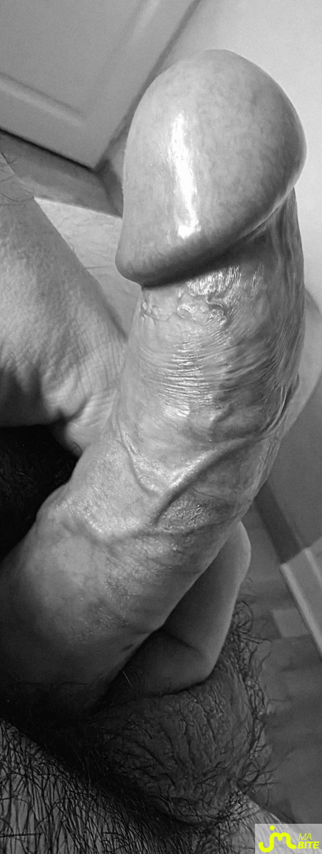 bites de bite_&ocirc;_veines
