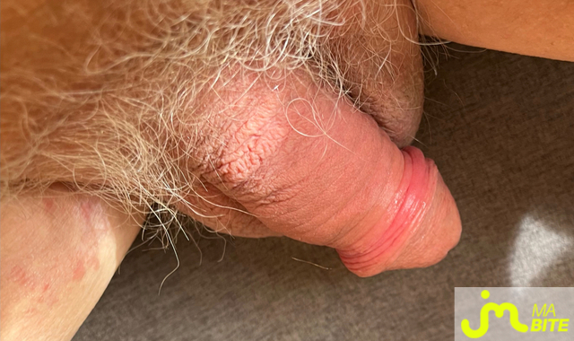 bites de Pop Art