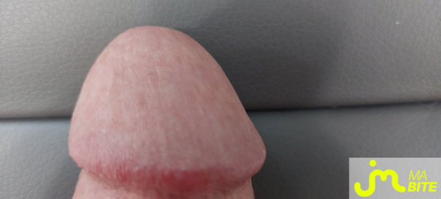 bites de PLUGMAN