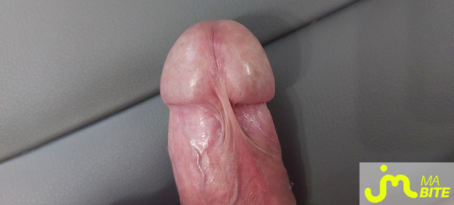 bites de PLUGMAN