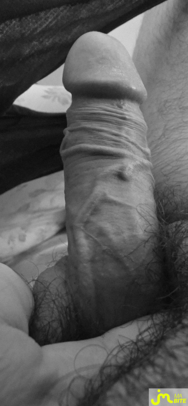 bites de bite_&ocirc;_veines