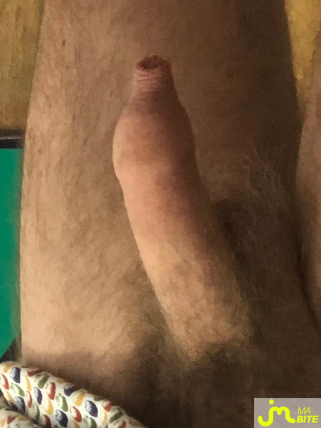 bites de longprepuce