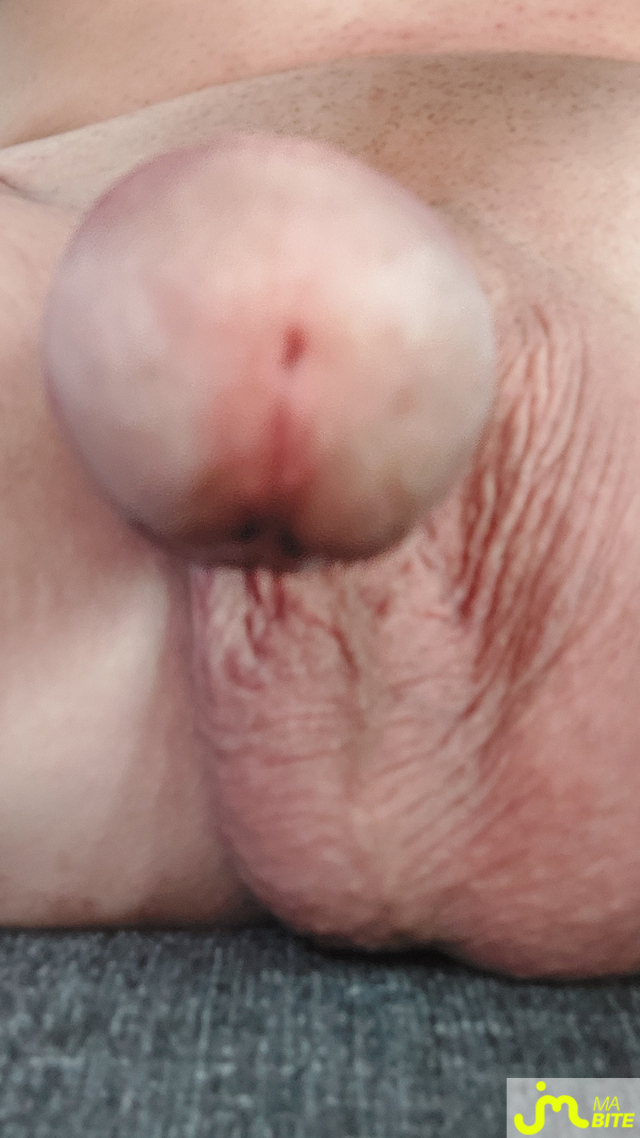 bites de PLUGMAN